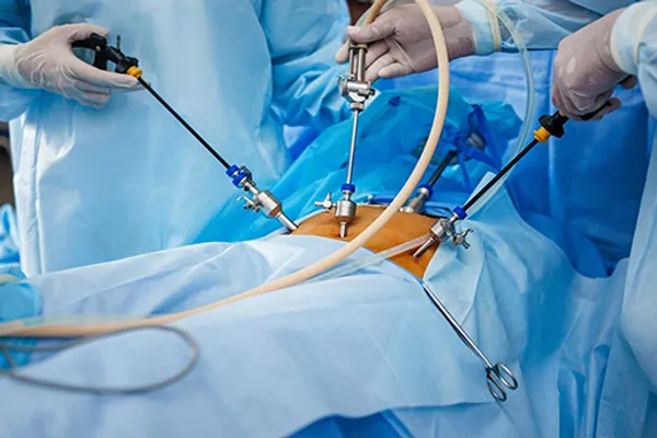 Laparoscopic Hernia Surgery in Ahmedabad