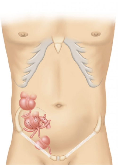 Appendix Doctor In Ahmedabad