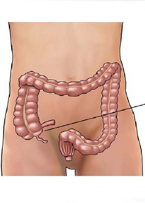 Appendix Specialist In Ahmedabad