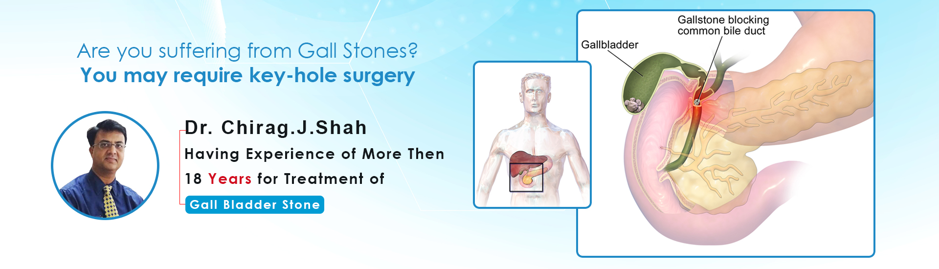Gall Bladder Stone Removal Doctor in Ahmedabad